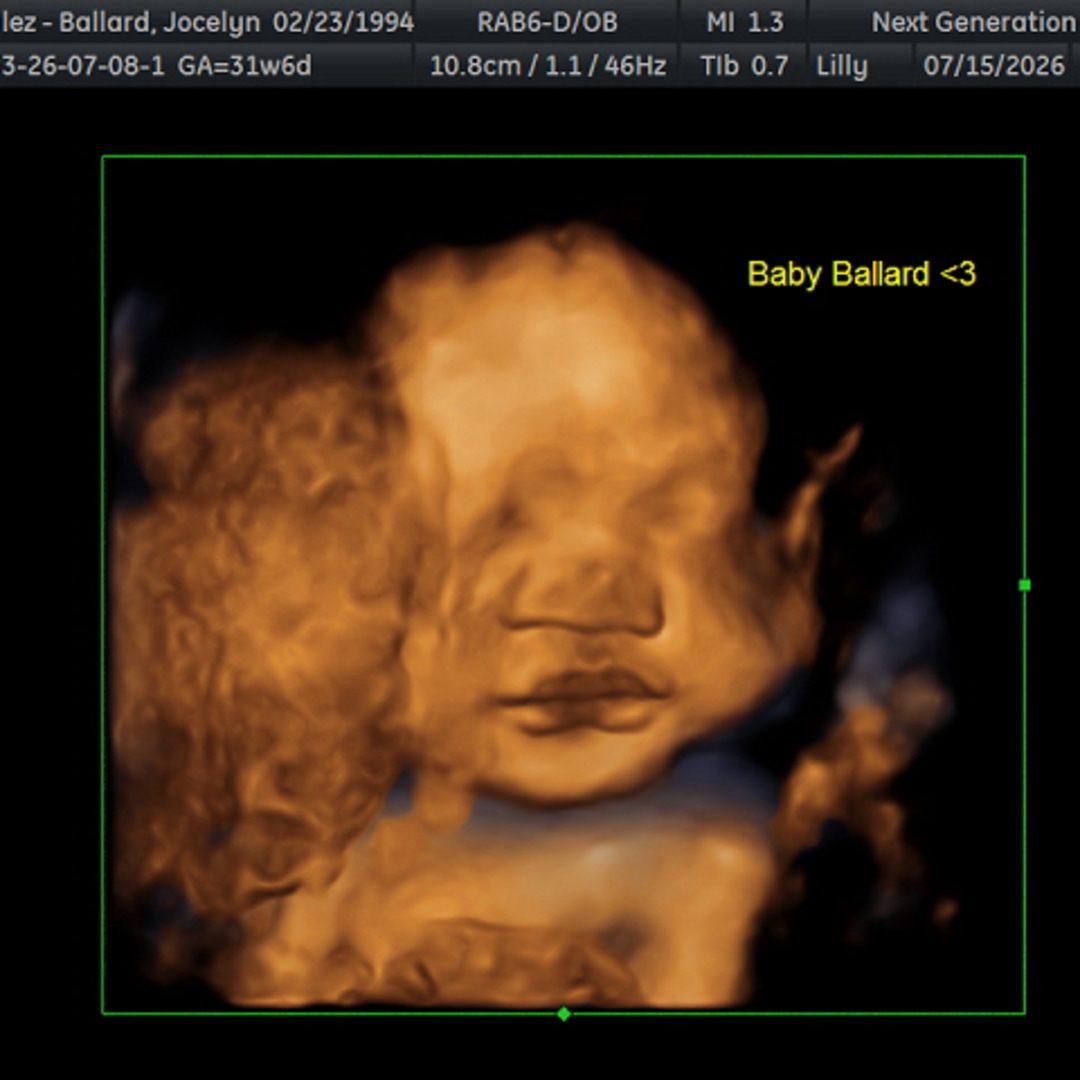 Photo shared by Jocelyn for their Babylist baby registry.