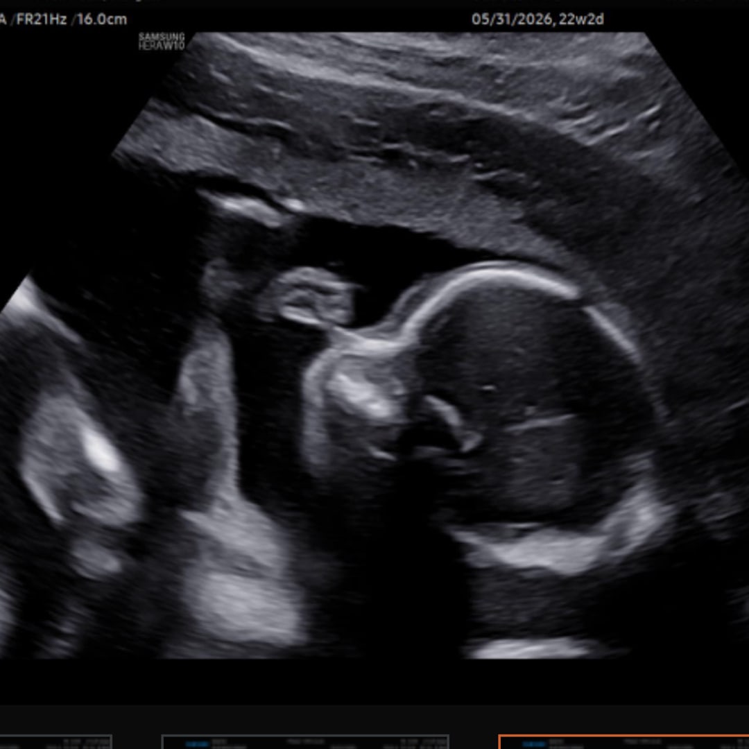 Photo shared by Abby for their Babylist baby registry.