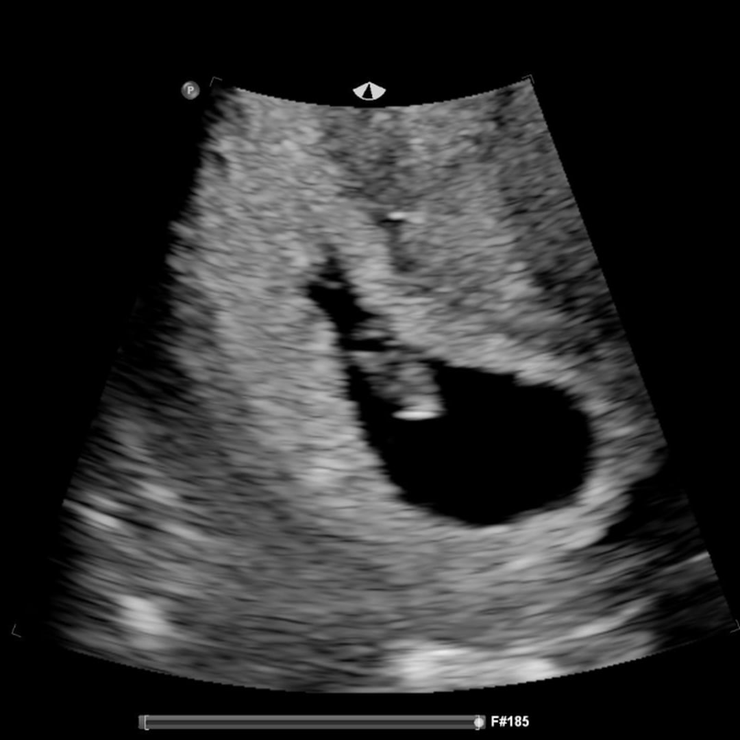 Photo shared by Erica for their Babylist baby registry.