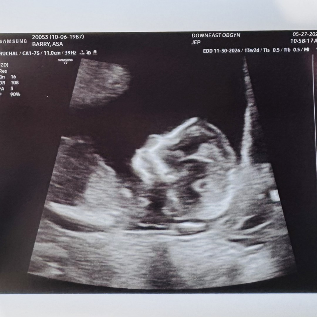 Photo shared by Asa for their Babylist baby registry.