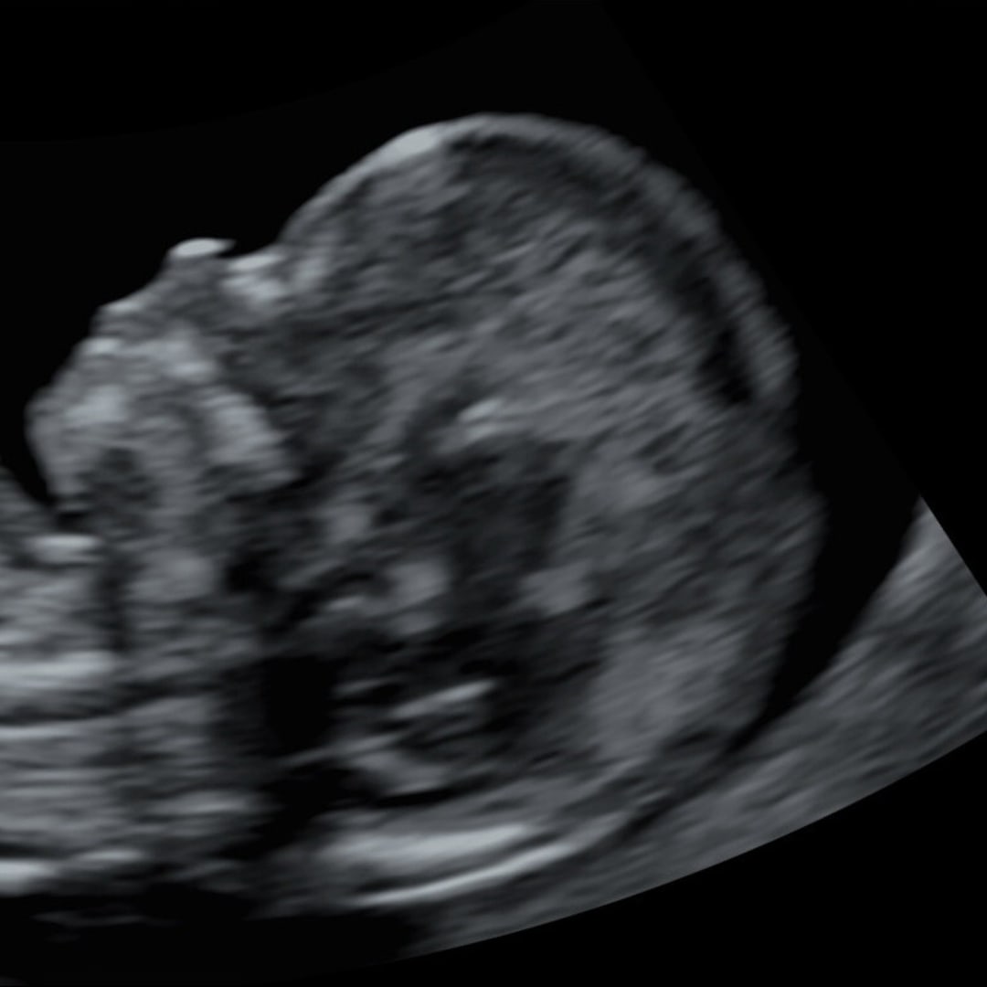 Photo shared by Abigail for their Babylist baby registry.