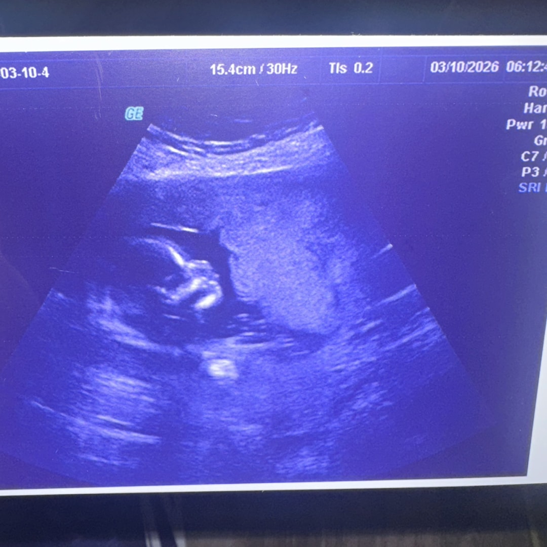 Photo shared by Kaitlyn for their Babylist baby registry.