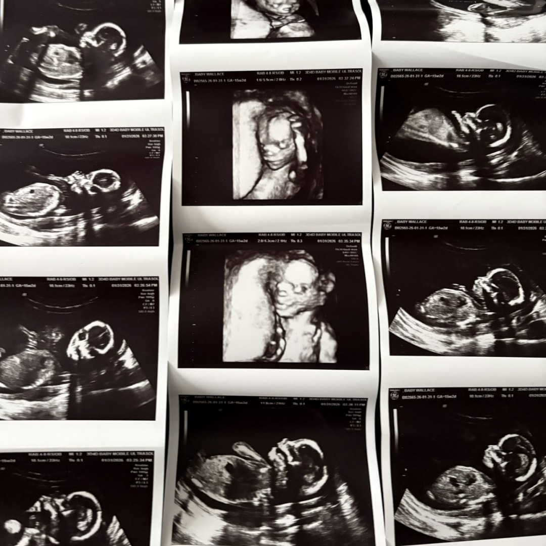 Photo shared by Sydney for their Babylist baby registry.