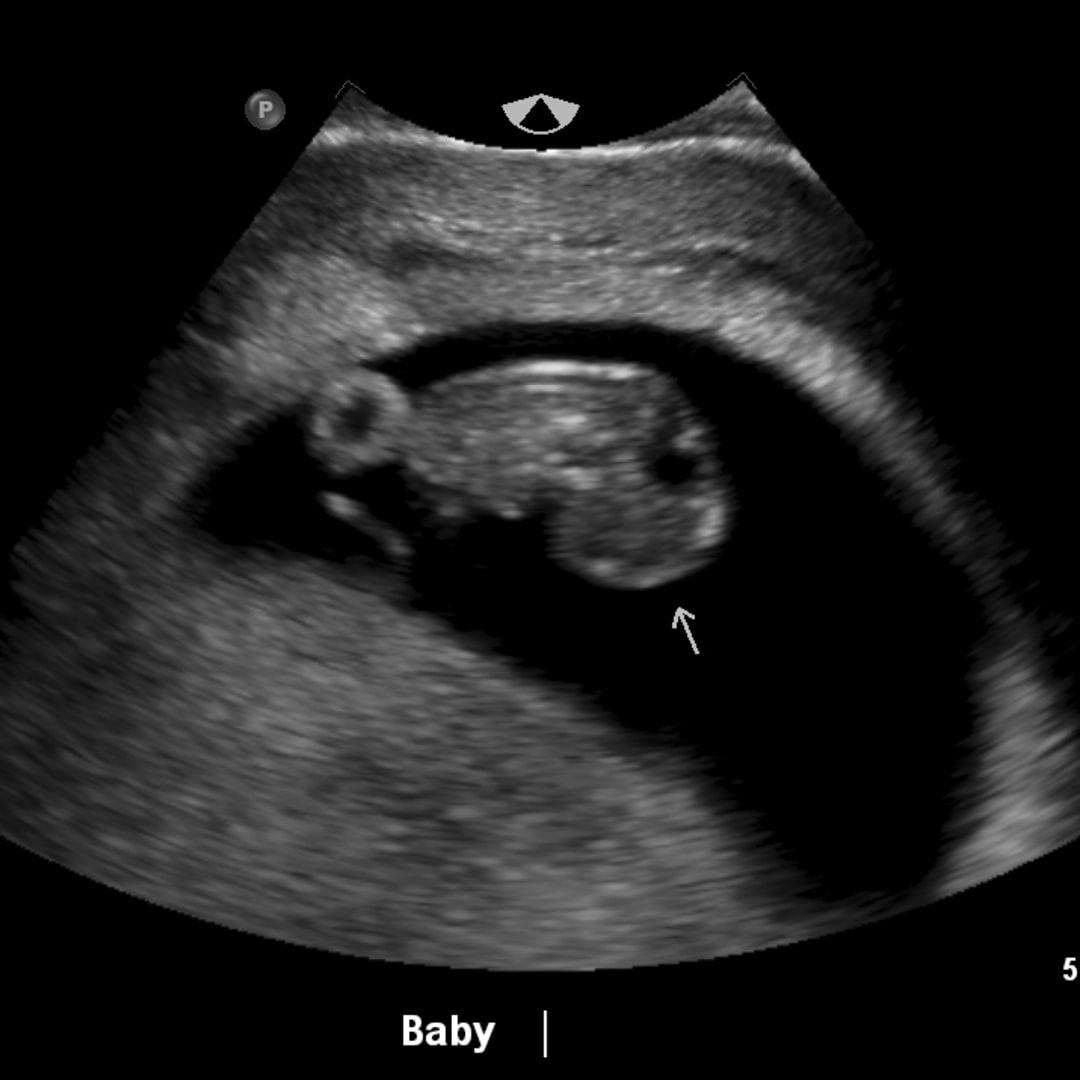 Photo shared by Delaney for their Babylist baby registry.