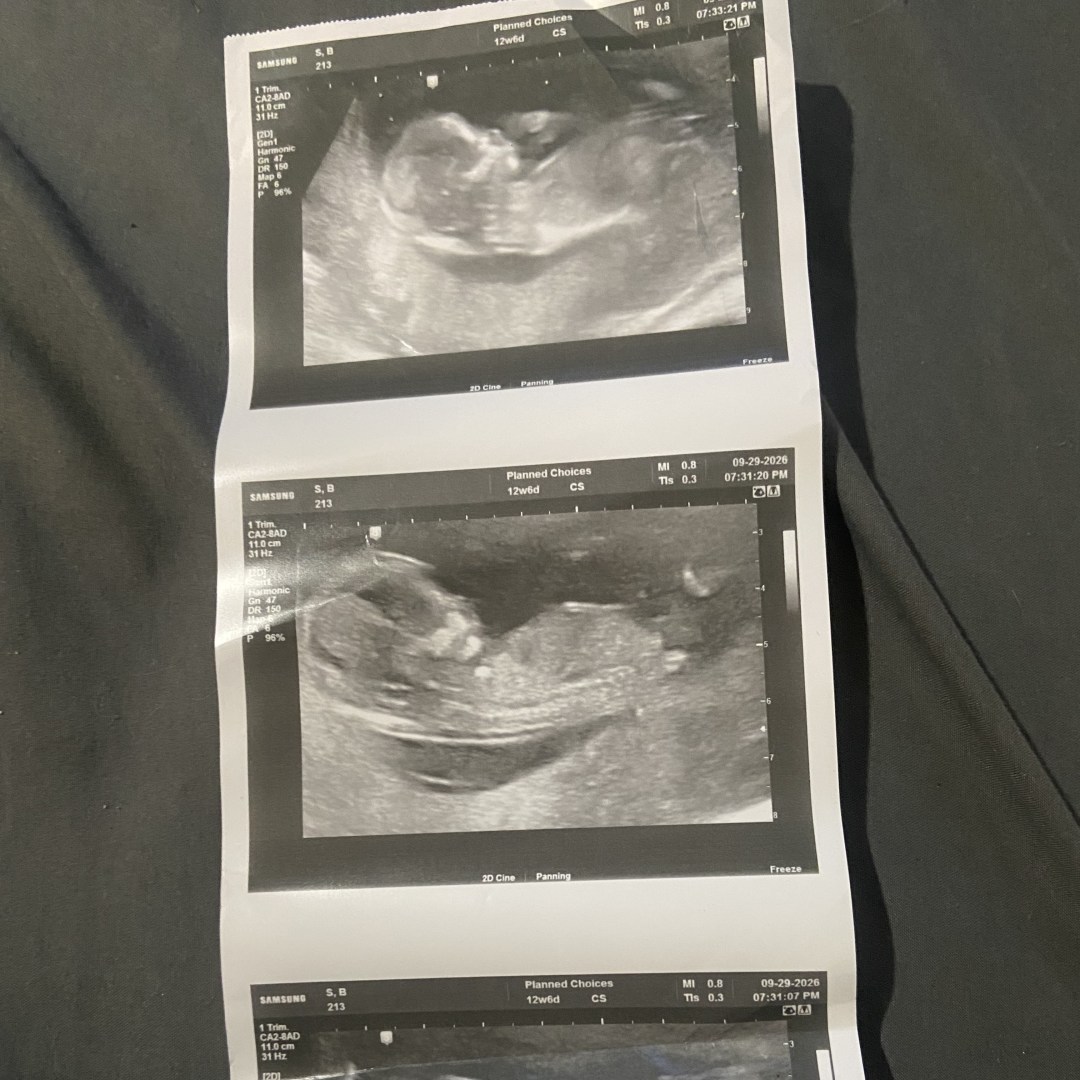 Photo shared by Brandi for their Babylist baby registry.