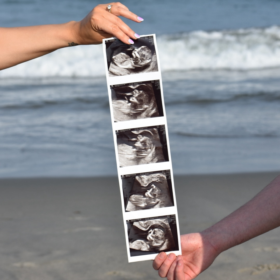 Photo shared by Allie for their Babylist baby registry.