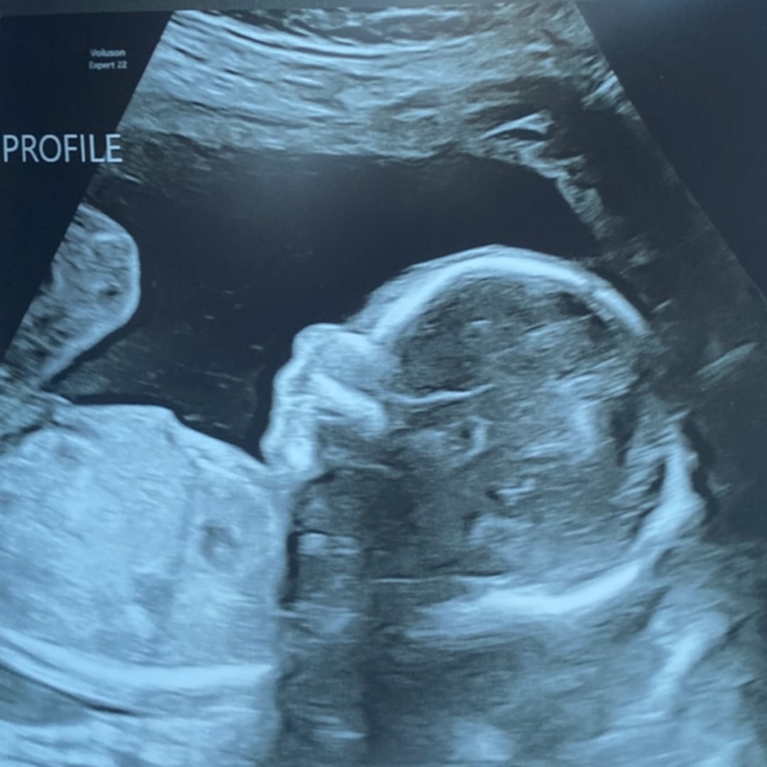 Photo shared by Kenzie for their Babylist baby registry.