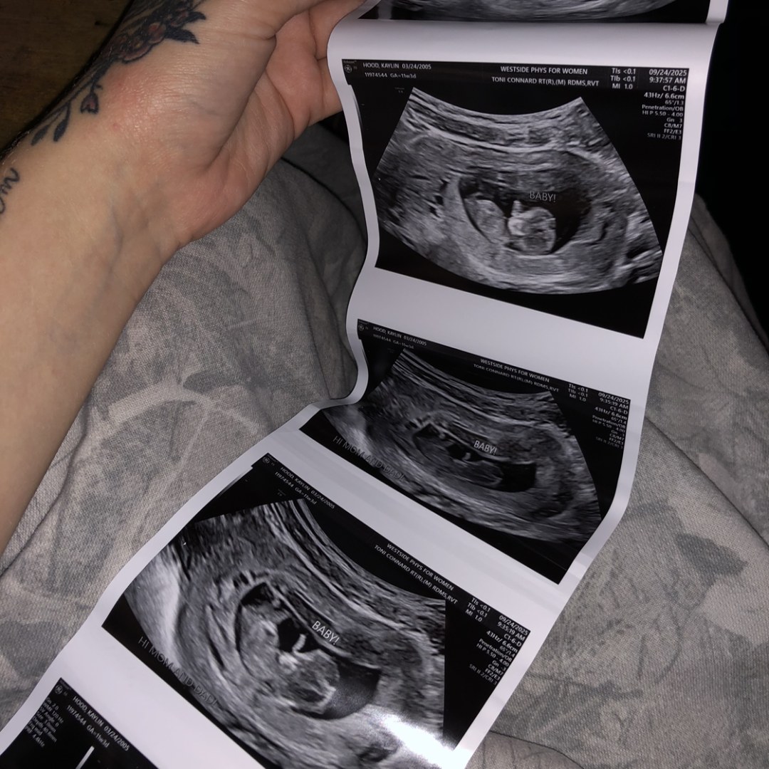 Photo shared by Kaylin for their Babylist baby registry.