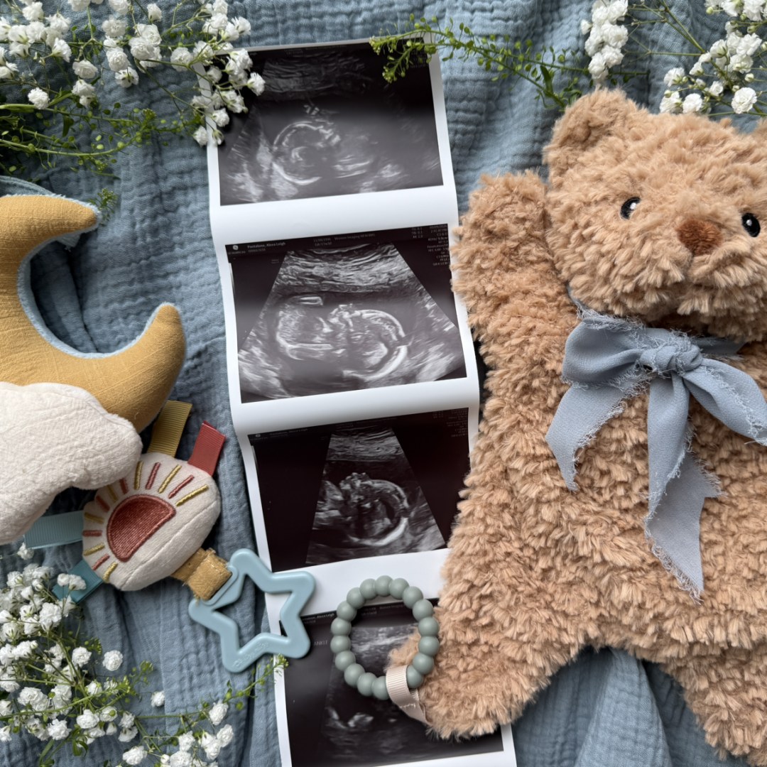 Photo shared by Alexa for their Babylist baby registry.