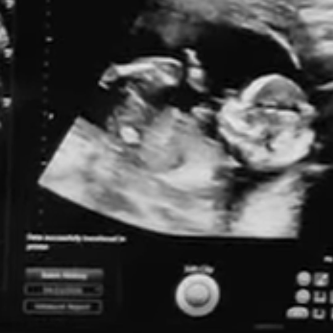 Photo shared by Carslyn for their Babylist baby registry.