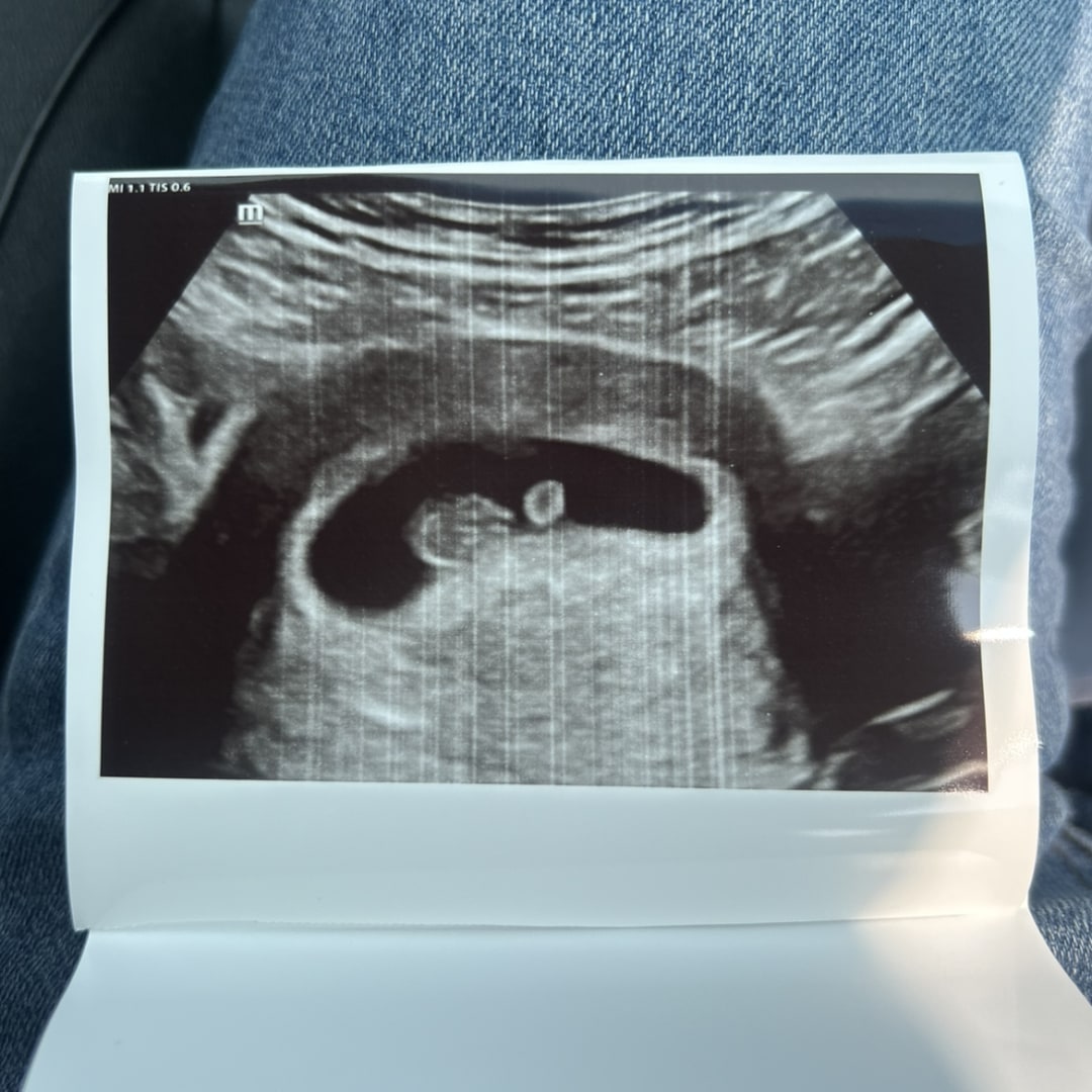 Photo shared by Jeimmylis for their Babylist baby registry.