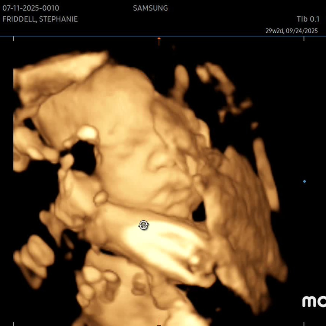 Photo shared by Stephanie for their Babylist baby registry.