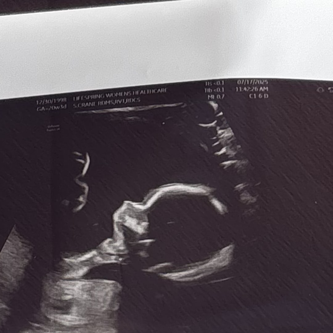Photo shared by Alyssa for their Babylist baby registry.