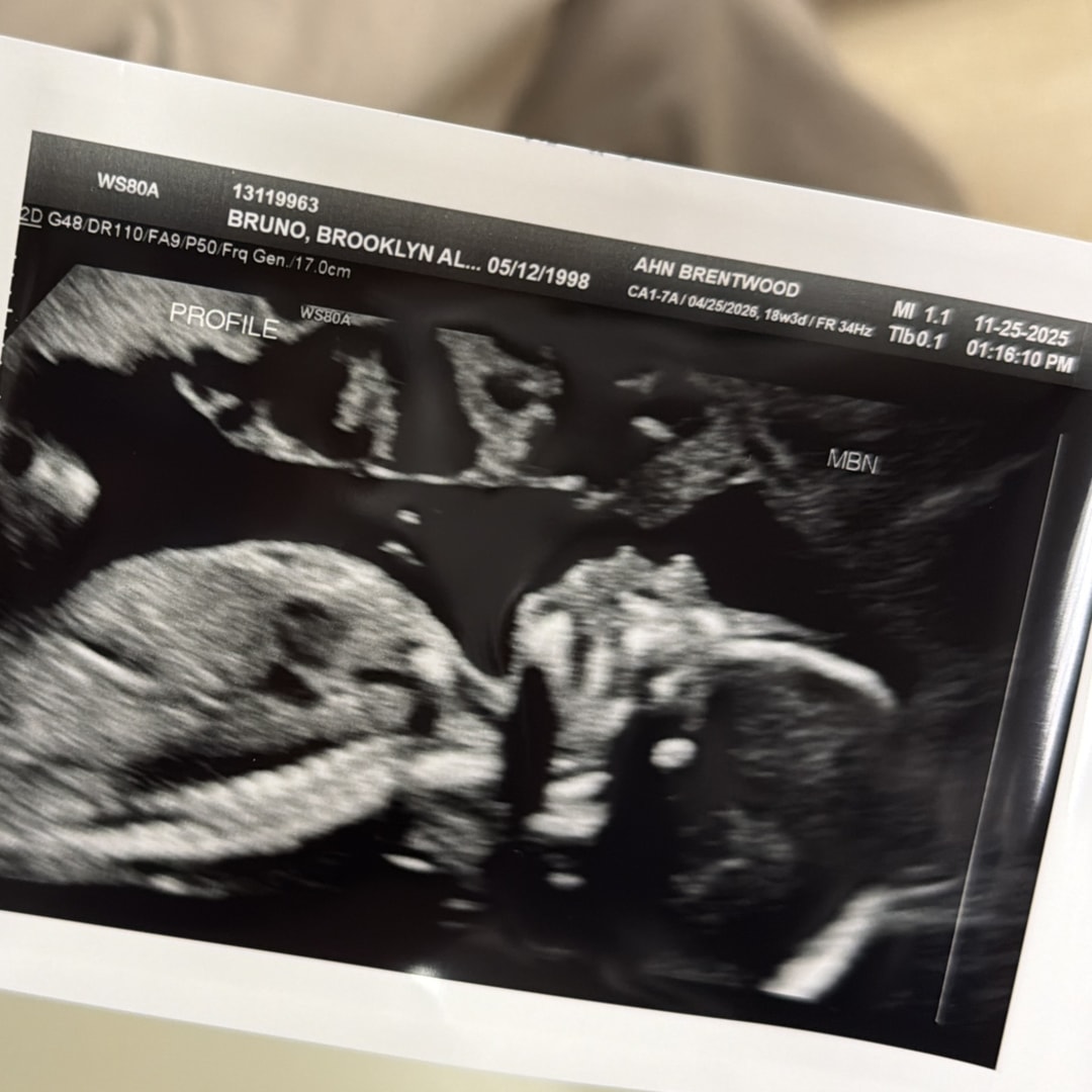 Photo shared by Brooklyn for their Babylist baby registry.