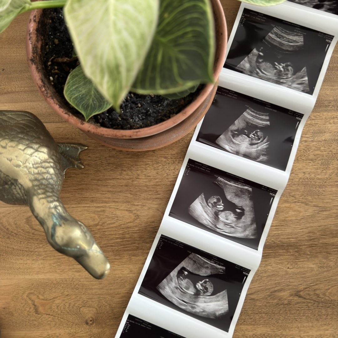 Photo shared by Adele for their Babylist baby registry.