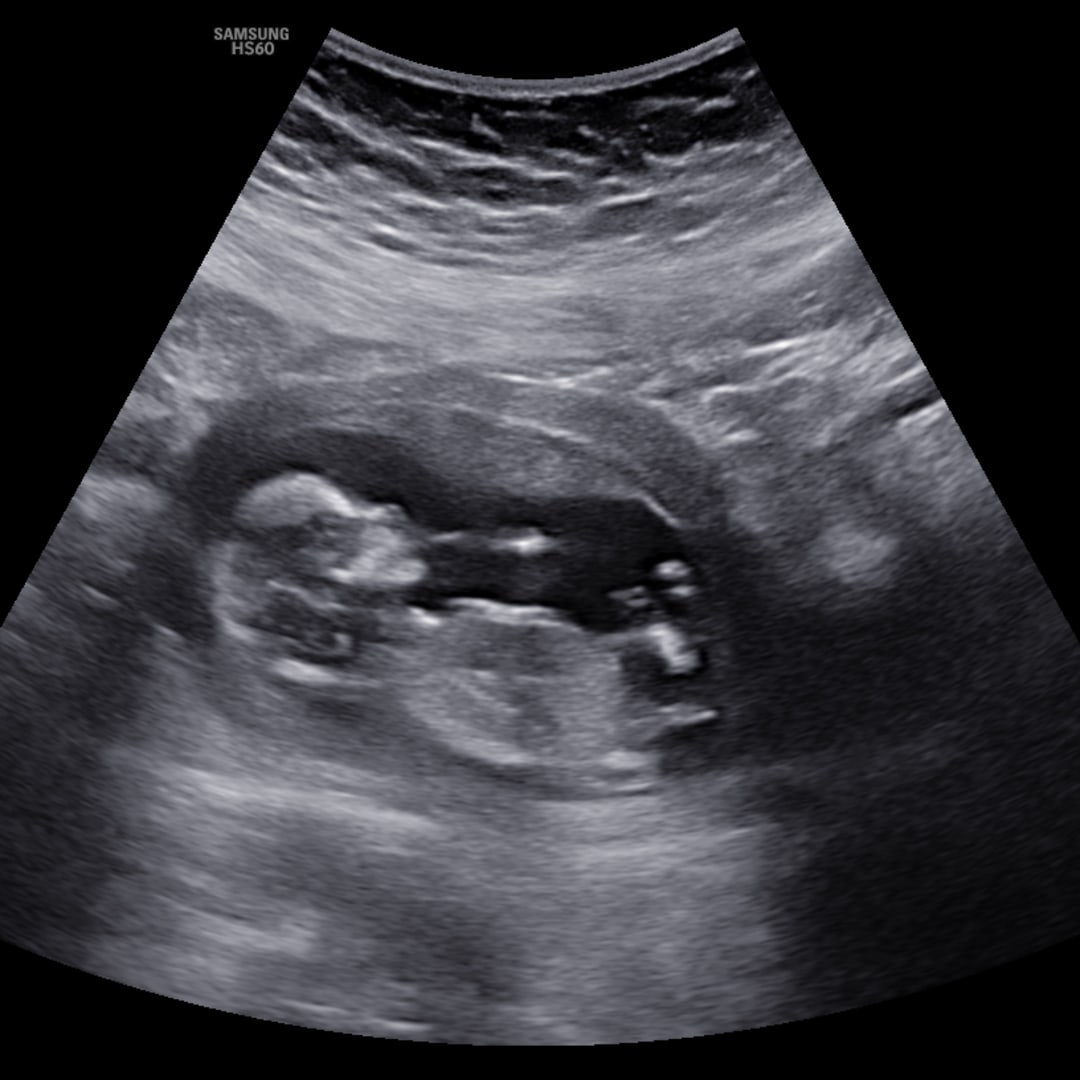 Photo shared by Katie for their Babylist baby registry.