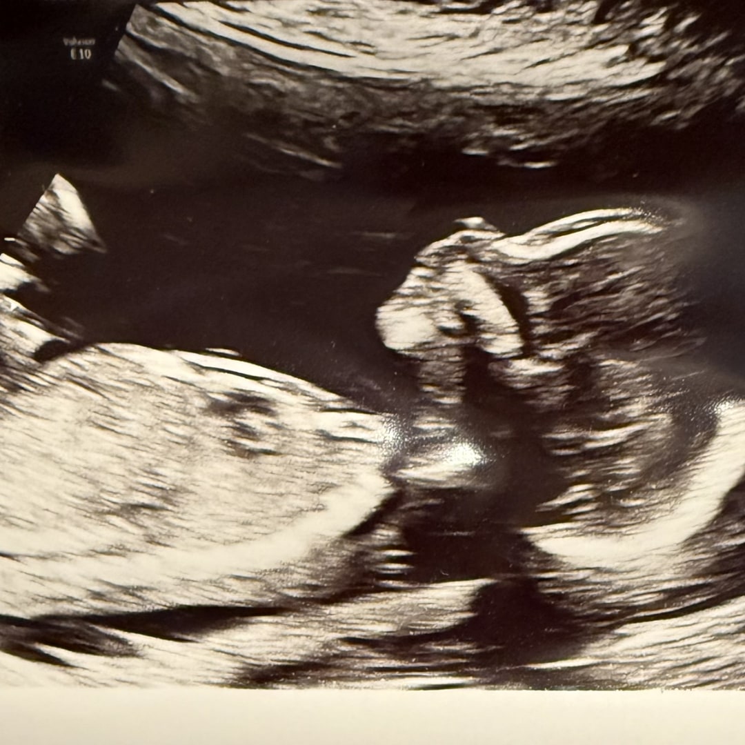 Photo shared by Ashley for their Babylist baby registry.