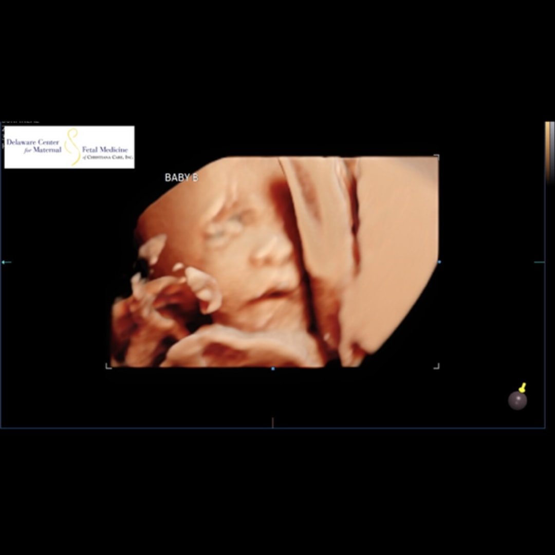 Photo shared by Jeanna for their Babylist baby registry.