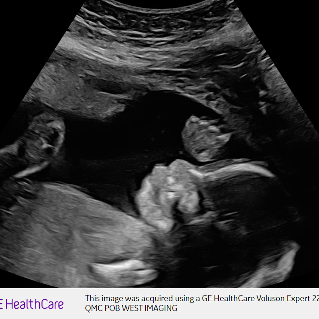 Photo shared by Giovanna for their Babylist baby registry.