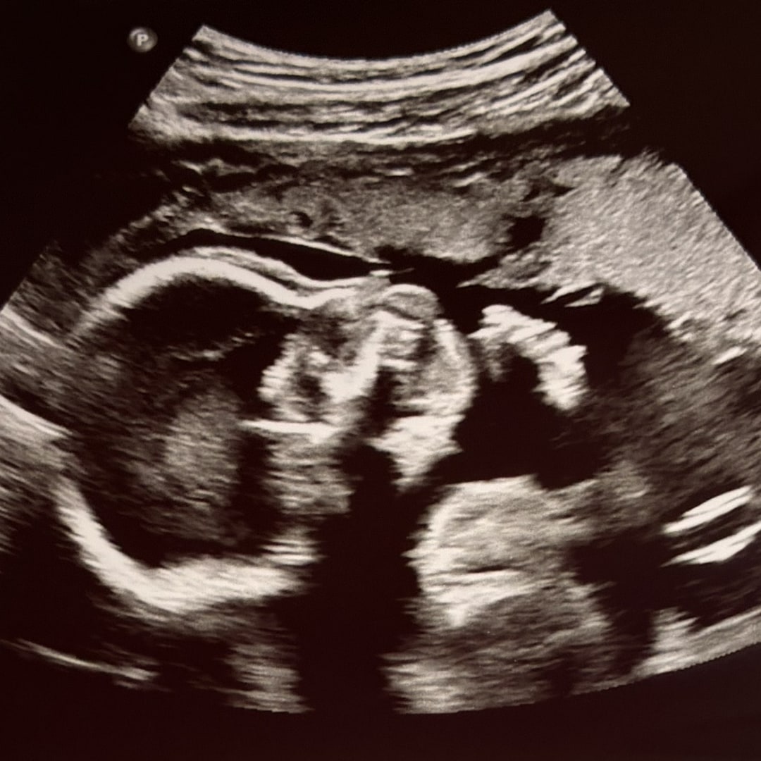 Photo shared by Camryn for their Babylist baby registry.