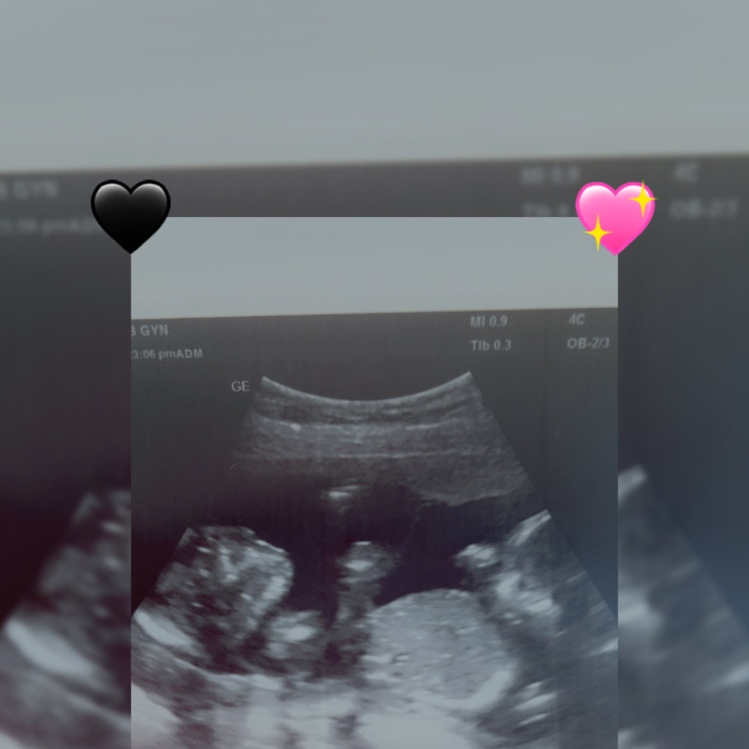 Photo shared by Sarah for their Babylist baby registry.