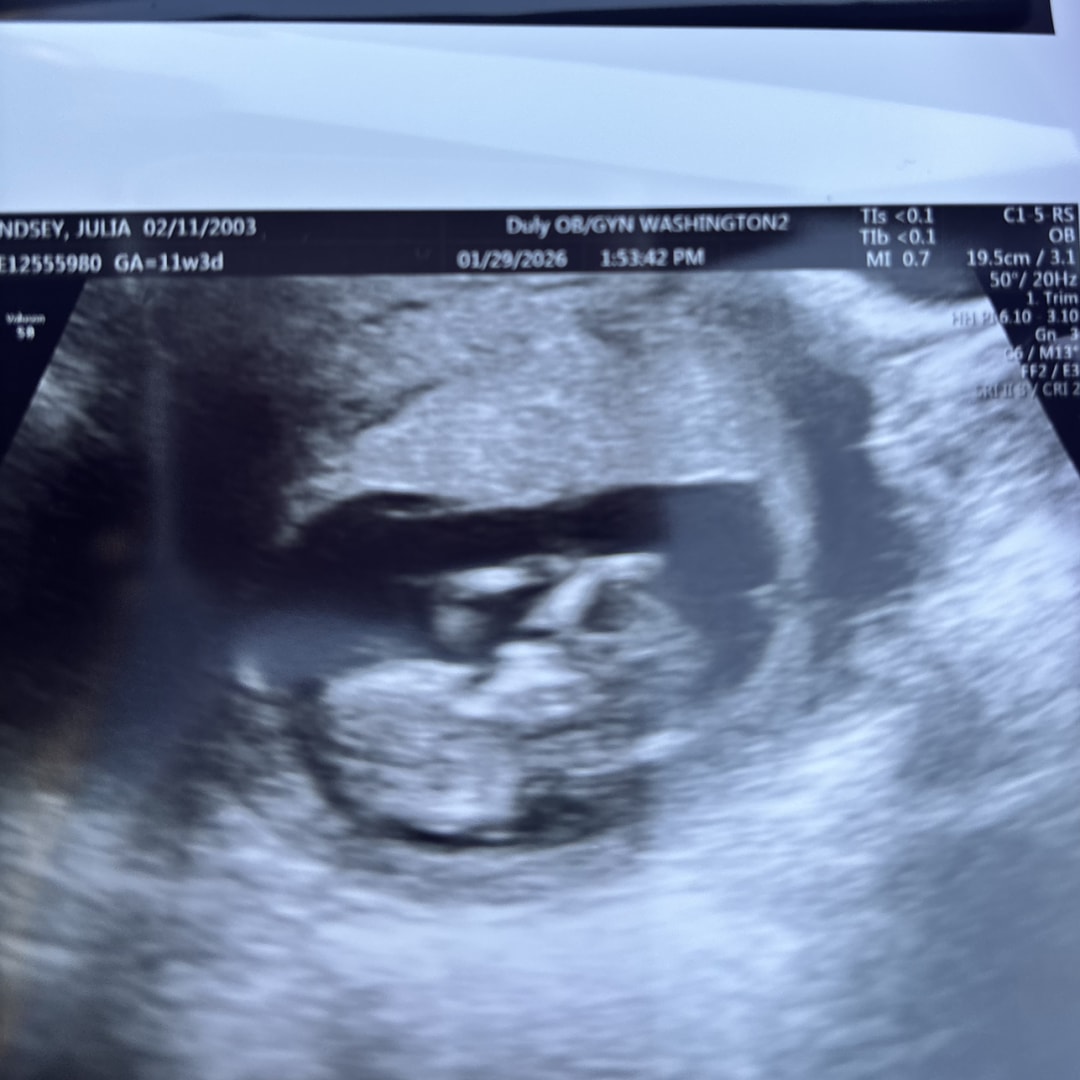 Photo shared by Julia for their Babylist baby registry.