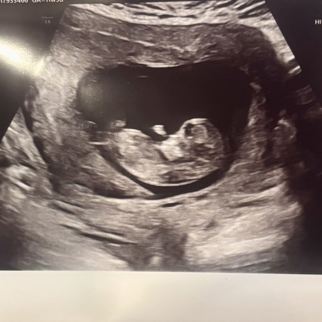 Photo shared by Christian for their Babylist baby registry.