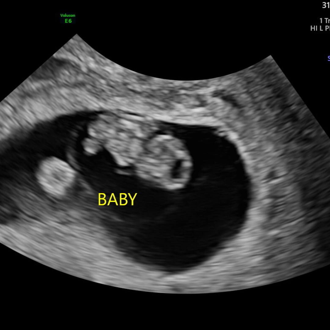 Photo shared by Rebecca for their Babylist baby registry.
