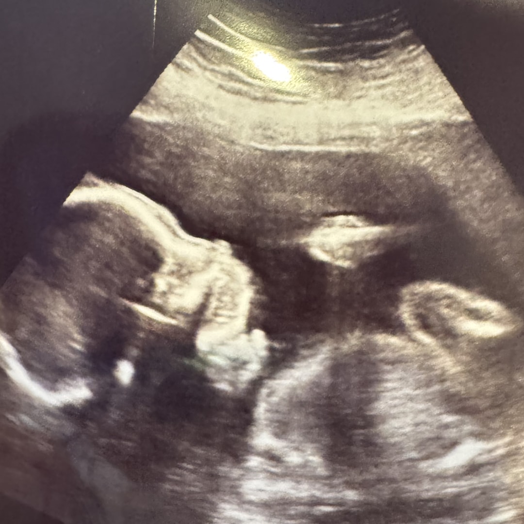 Photo shared by Mirly for their Babylist baby registry.