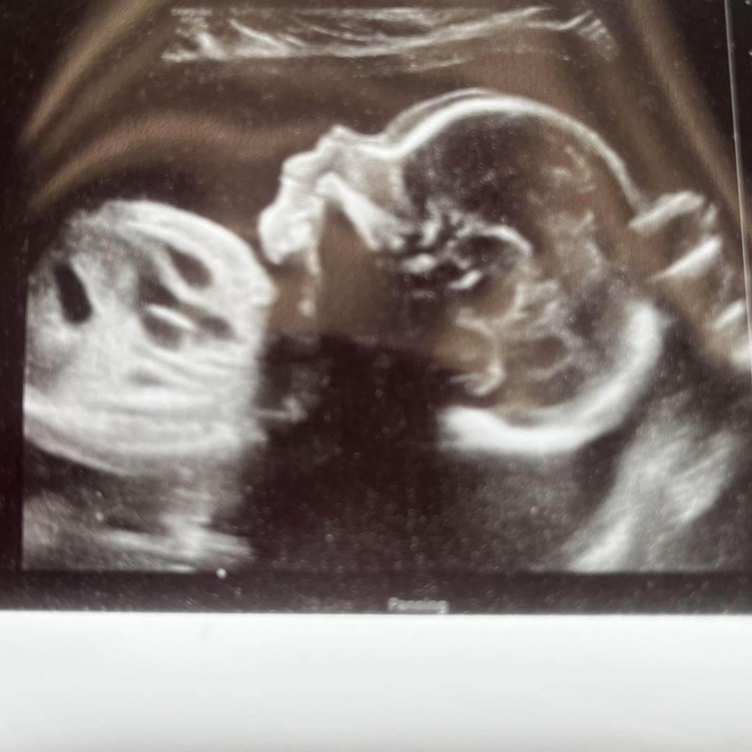 Photo shared by Danasia for their Babylist baby registry.