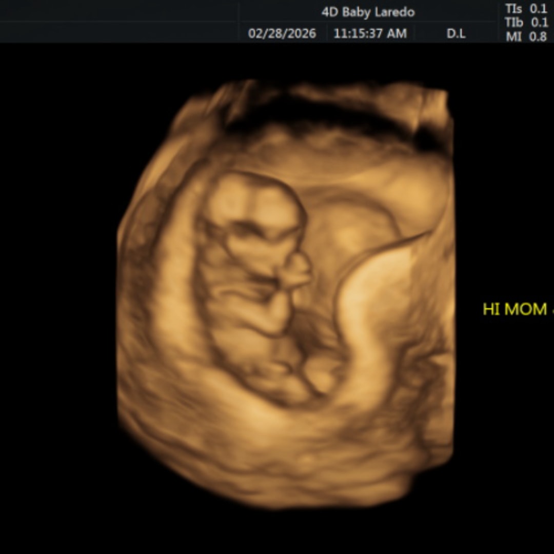 Photo shared by Erin for their Babylist baby registry.