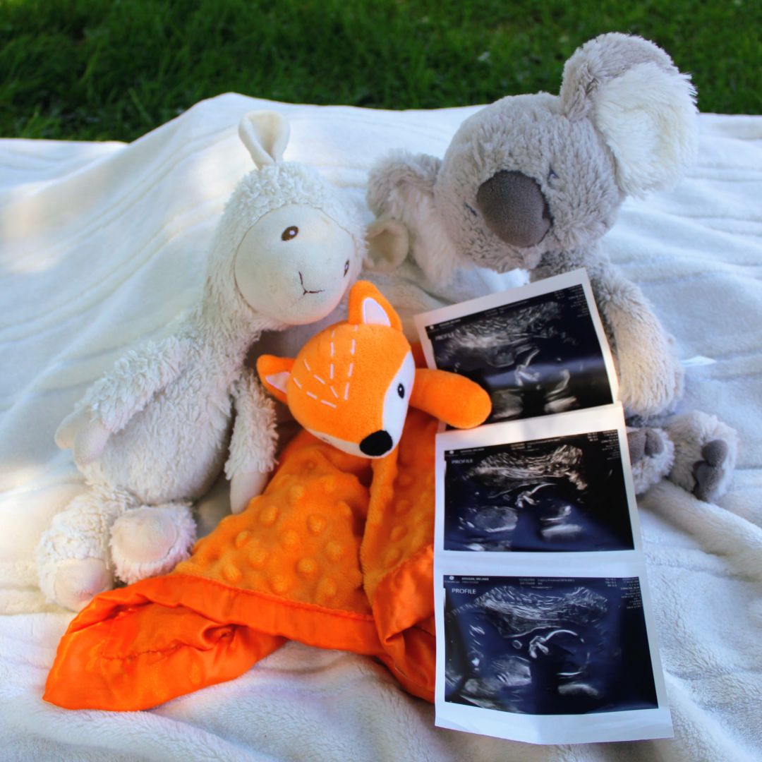 Photo shared by Melanie & Seth for their Babylist baby registry.