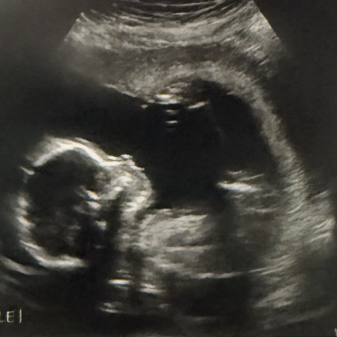 Photo shared by Emily for their Babylist baby registry.