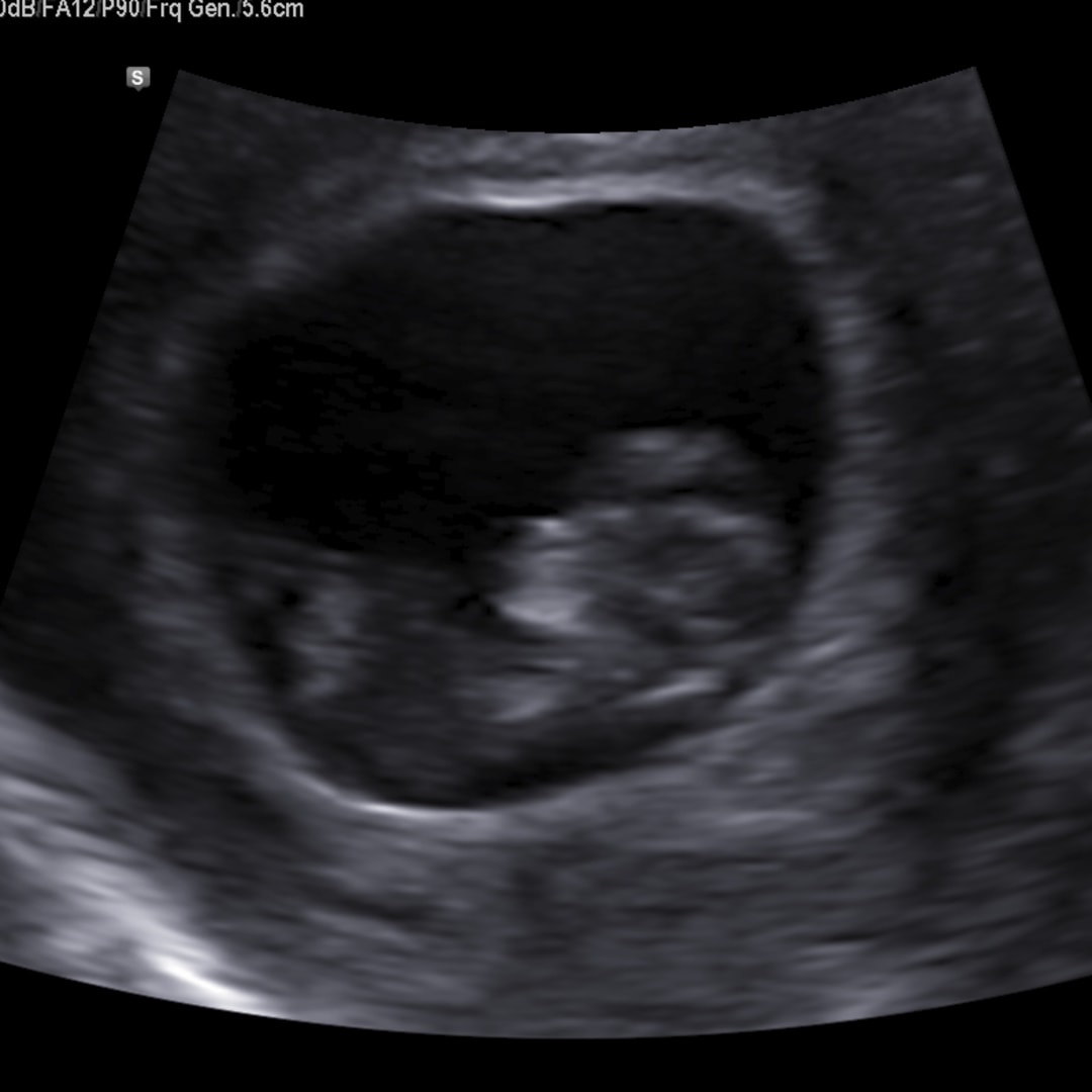 Photo shared by Breanna for their Babylist baby registry.