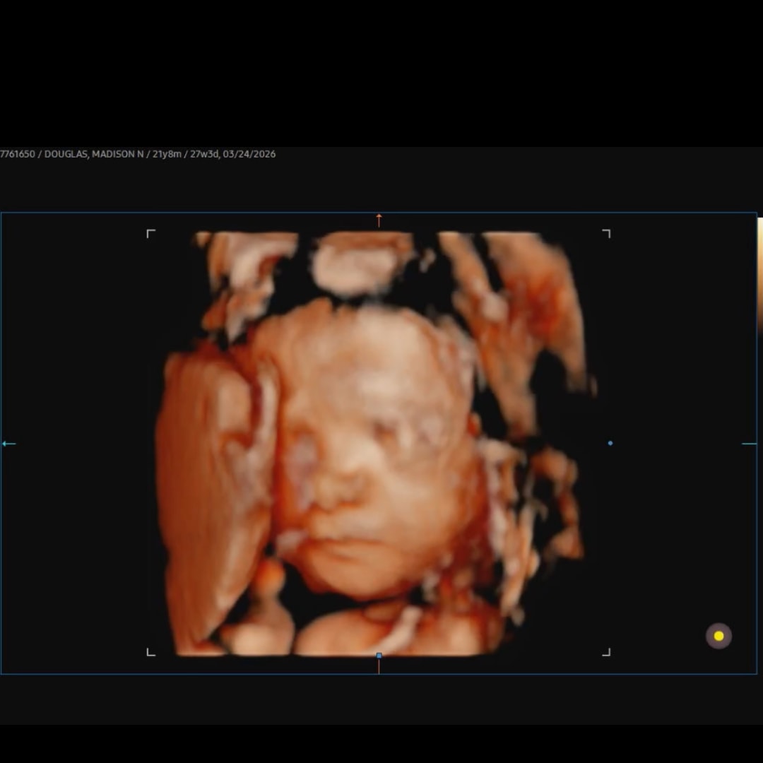 Photo shared by Maddie for their Babylist baby registry.