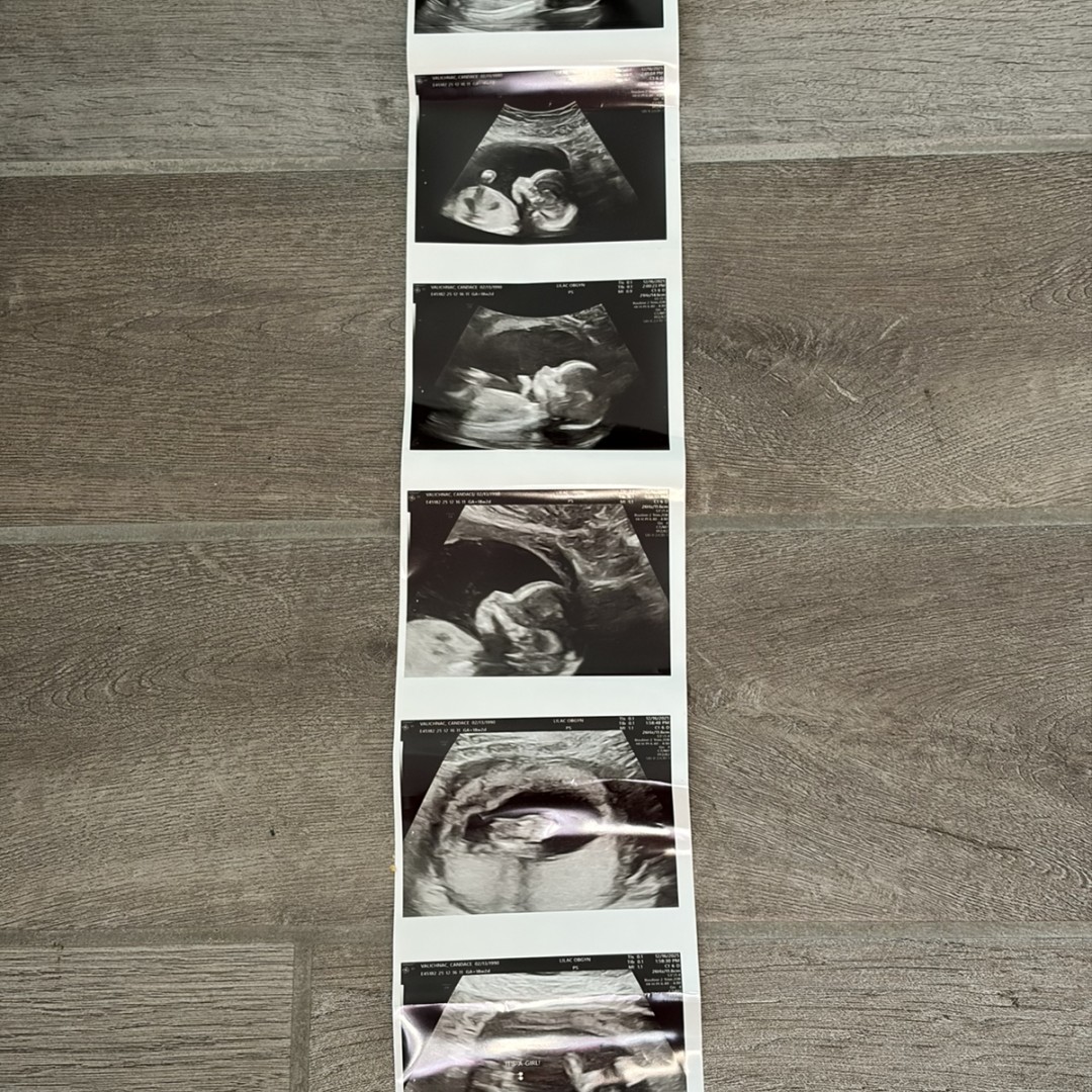 Photo shared by Candace for their Babylist baby registry.