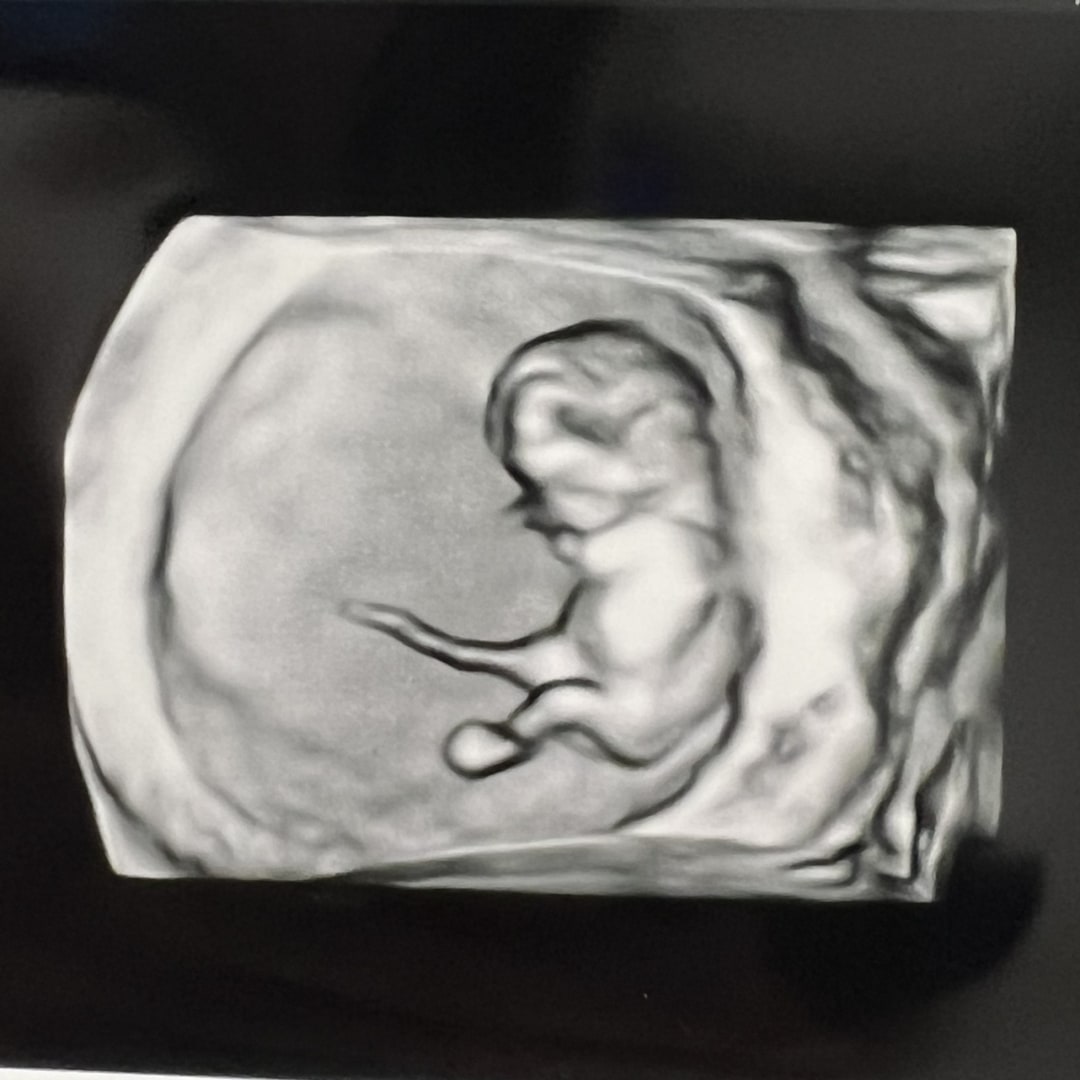 Photo shared by Gracie for their Babylist baby registry.