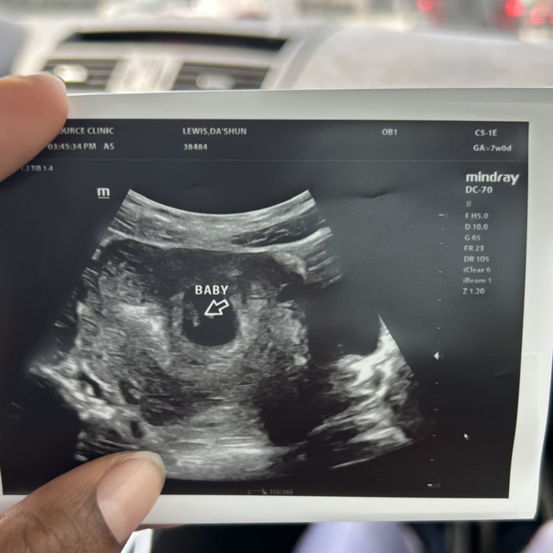 Photo shared by Dashun for their Babylist baby registry.