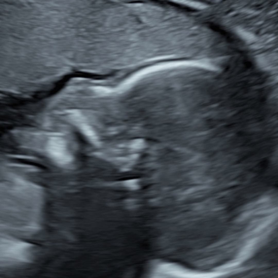 Photo shared by Erik for their Babylist baby registry.