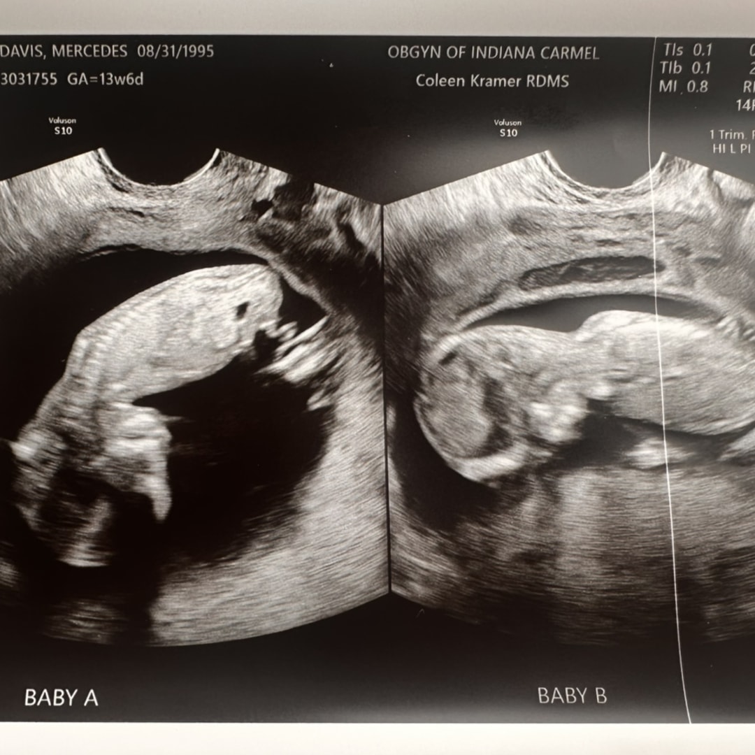 Photo shared by Mercedes for their Babylist baby registry.