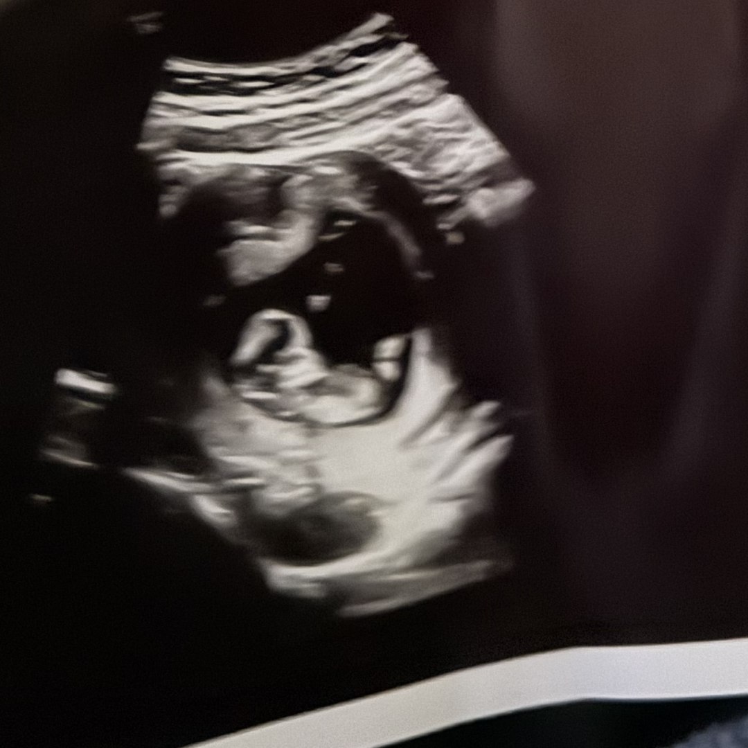 Photo shared by Analiyah for their Babylist baby registry.