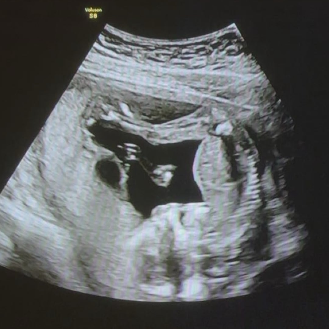 Photo shared by Cheyenne for their Babylist baby registry.