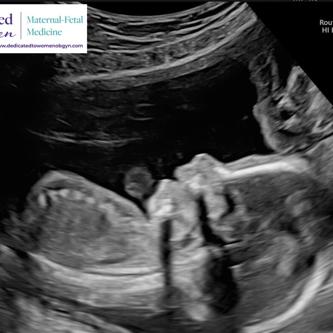 Photo shared by Gabriella for their Babylist baby registry.