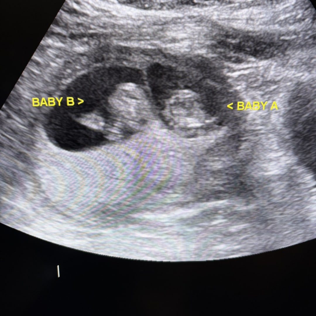 Photo shared by Alyssa for their Babylist baby registry.