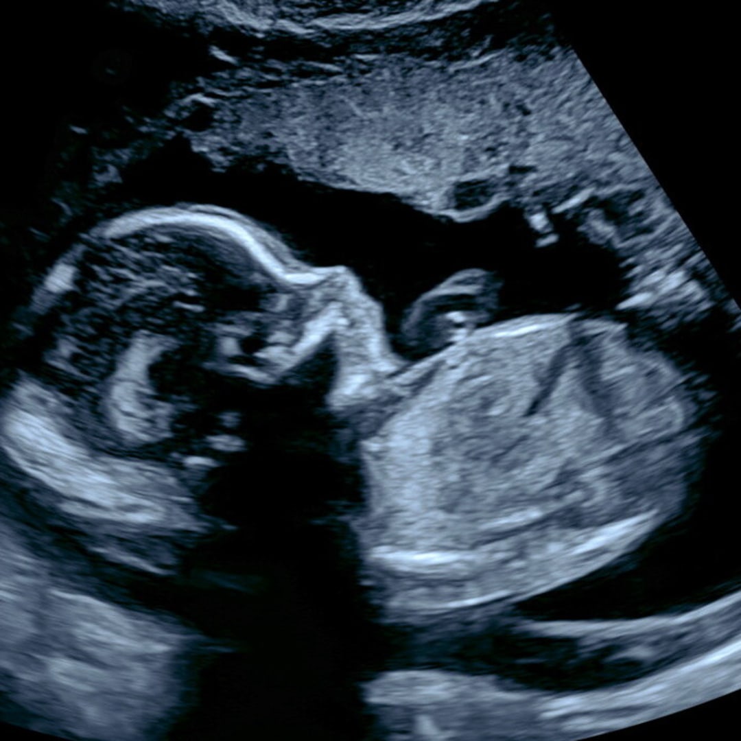 Photo shared by Colleen & for their Babylist baby registry.