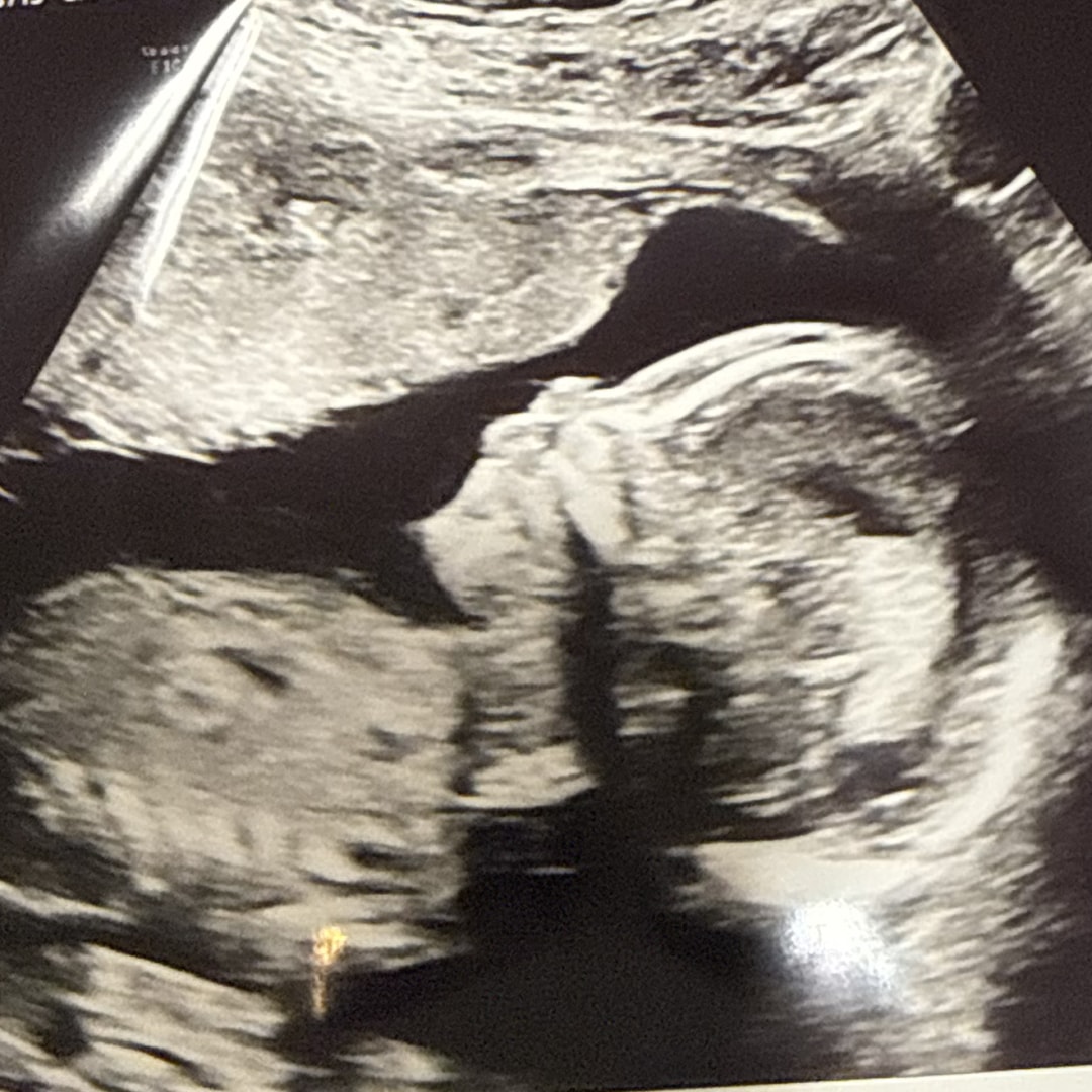 Photo shared by Angelika for their Babylist baby registry.