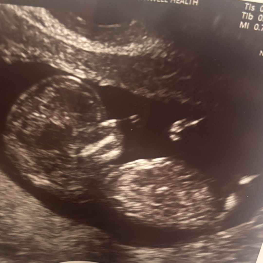 Photo shared by Danielle for their Babylist baby registry.
