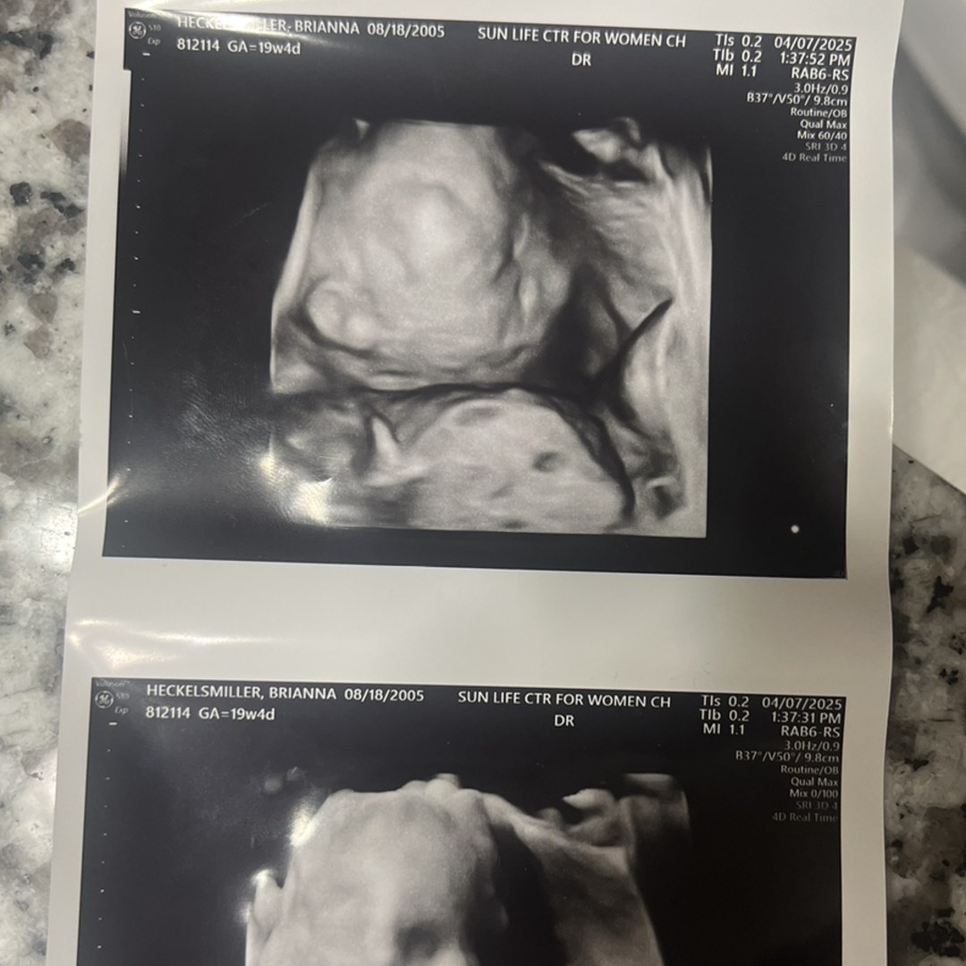 Photo shared by Brianna for their Babylist baby registry.