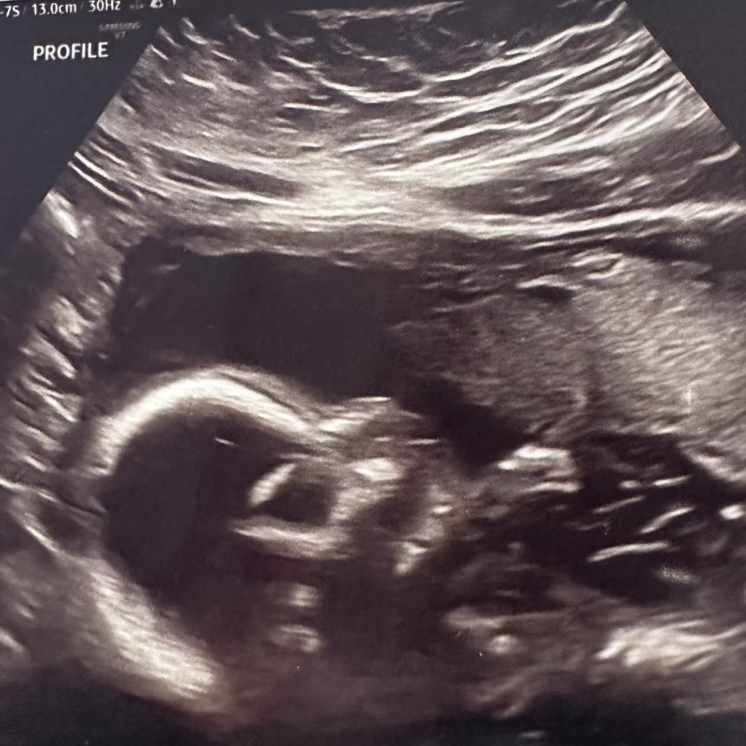 Photo shared by Jessica for their Babylist baby registry.