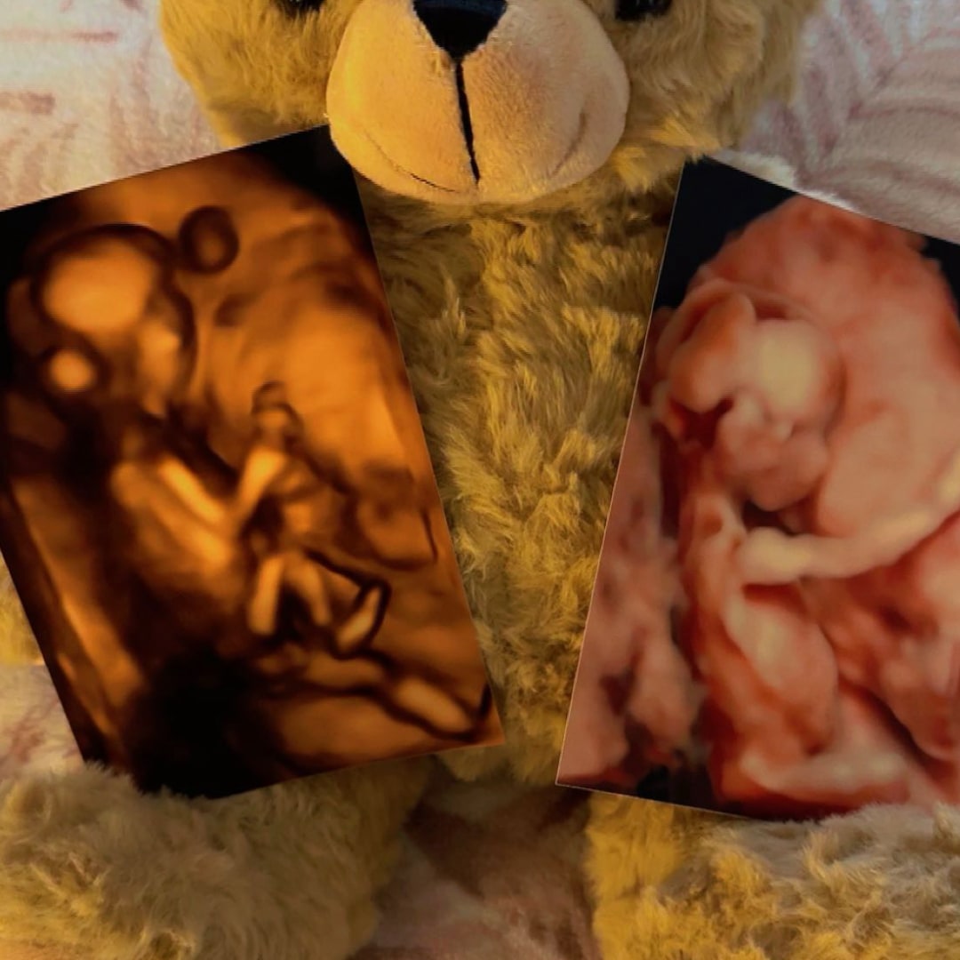 Photo shared by Alex for their Babylist baby registry.